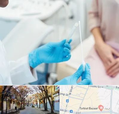 دکتر زگیل تناسلی HPV در تربیت تبریز