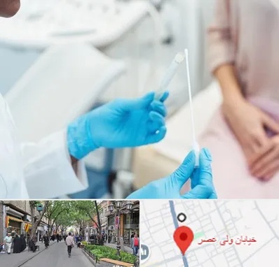 دکتر زگیل تناسلی HPV در ولیعصر شهریار