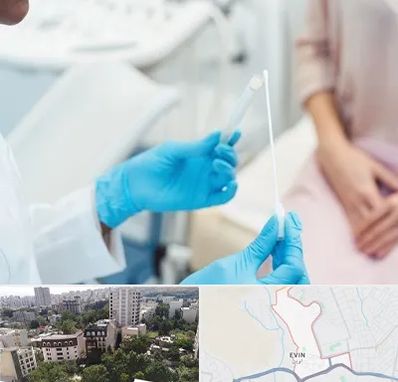 دکتر زگیل تناسلی HPV در اوین