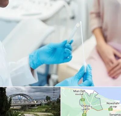 دکتر زگیل تناسلی HPV در چالوس