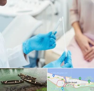 دکتر زگیل تناسلی HPV در بندر انزلی