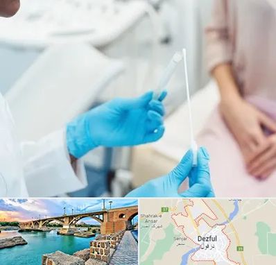 دکتر زگیل تناسلی HPV در دزفول