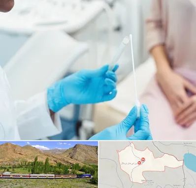 دکتر زگیل تناسلی HPV در خاش