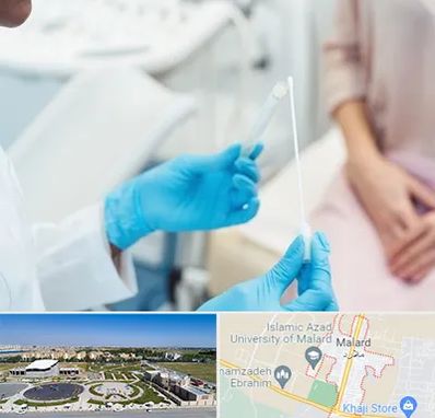 دکتر زگیل تناسلی HPV در ملارد