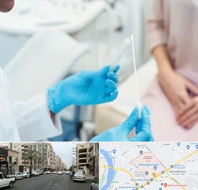 دکتر زگیل تناسلی HPV در زیتون کارمندی اهواز 