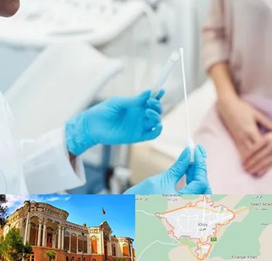 دکتر زگیل تناسلی HPV در خوی