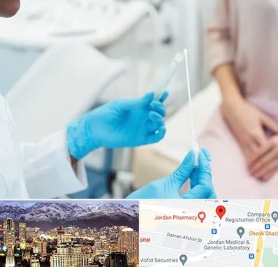 دکتر زگیل تناسلی HPV در جردن 