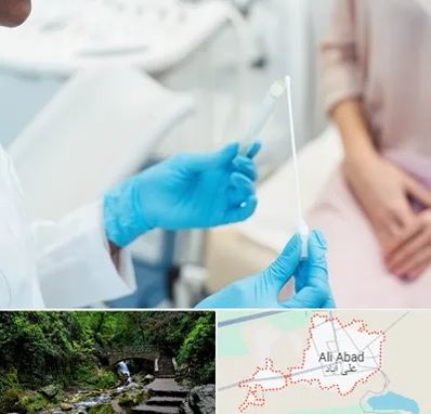 دکتر زگیل تناسلی HPV در علی آباد کتول