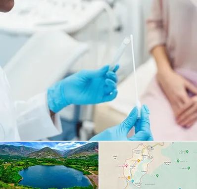 دکتر زگیل تناسلی HPV در رودبار