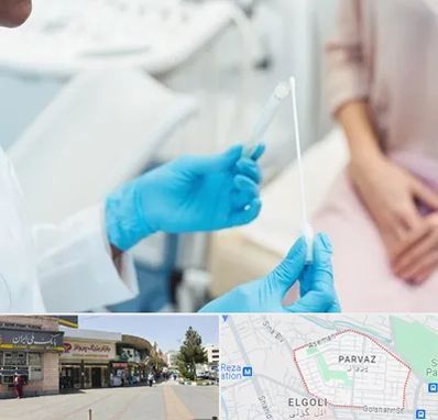 دکتر زگیل تناسلی HPV در پرواز تبریز