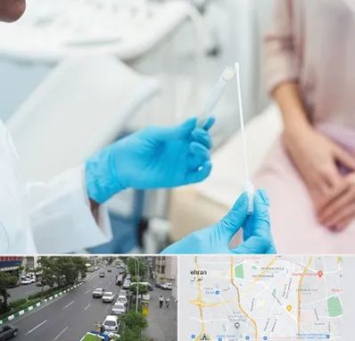 دکتر زگیل تناسلی HPV در ستارخان 