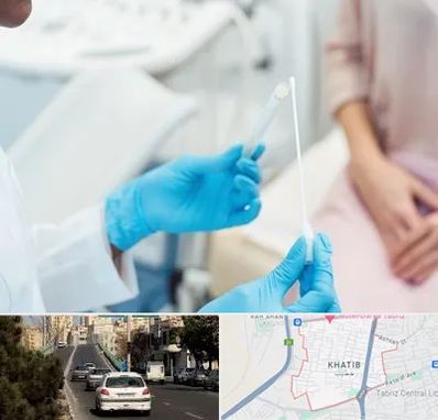 دکتر زگیل تناسلی HPV در خطیب تبریز