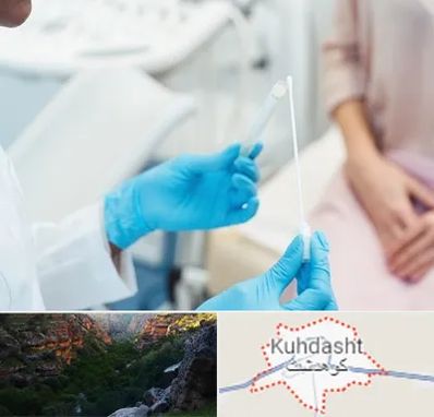 دکتر زگیل تناسلی HPV در کوهدشت