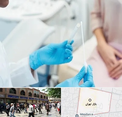 دکتر زگیل تناسلی HPV در بازار تهران