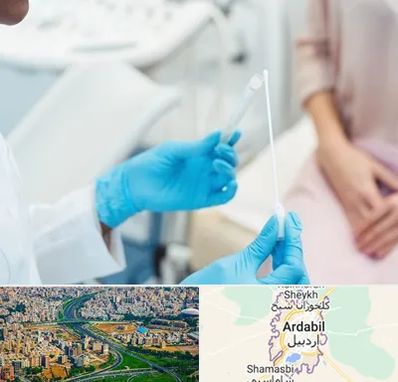 دکتر زگیل تناسلی HPV در اردبیل