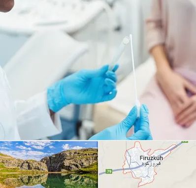 دکتر زگیل تناسلی HPV در فیروزکوه