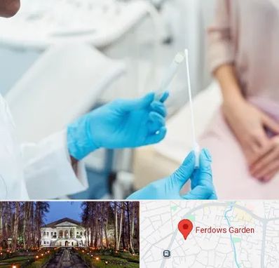 دکتر زگیل تناسلی HPV در باغ فردوس