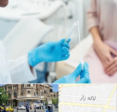 دکتر زگیل تناسلی HPV در لاله زار