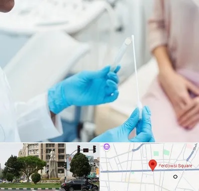 دکتر زگیل تناسلی HPV در میدان فردوسی تهران