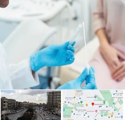 دکتر زگیل تناسلی HPV در بلوار فردوسی مشهد 