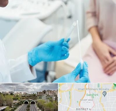 دکتر زگیل تناسلی HPV در یوسف آباد 