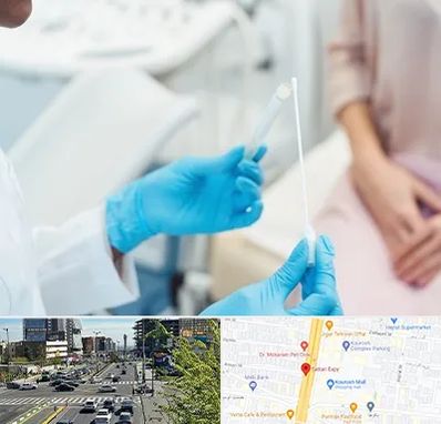 دکتر زگیل تناسلی HPV در ستاری 