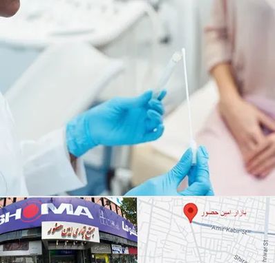 دکتر زگیل تناسلی HPV در امین حضور