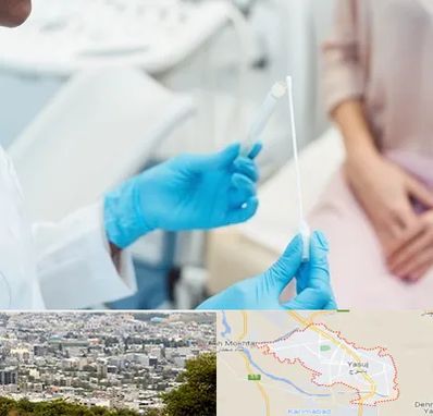 دکتر زگیل تناسلی HPV در یاسوج