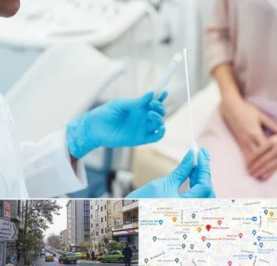 دکتر زگیل تناسلی HPV در فاطمی 