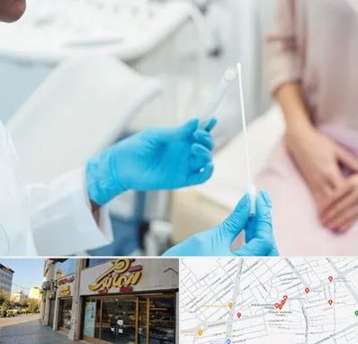 دکتر زگیل تناسلی HPV در عطاران قم