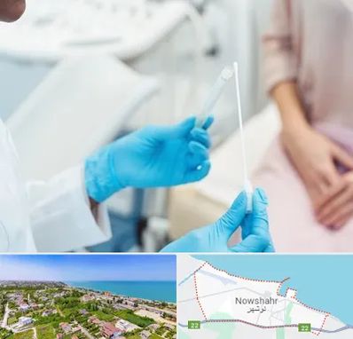 دکتر زگیل تناسلی HPV در نوشهر