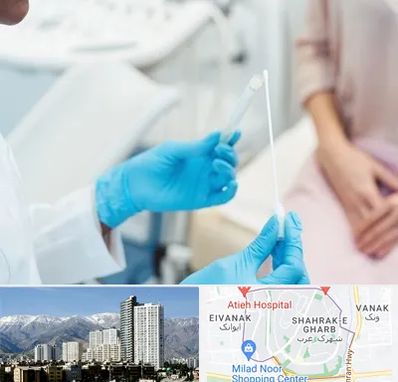 دکتر زگیل تناسلی HPV در شهرک غرب 