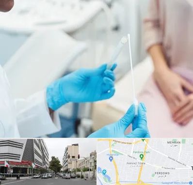 دکتر زگیل تناسلی HPV در بلوار فردوس 