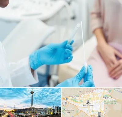 دکتر زگیل تناسلی HPV در تهران