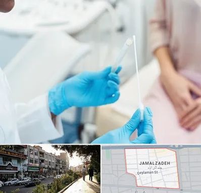 دکتر زگیل تناسلی HPV در خیابان جمالزاده
