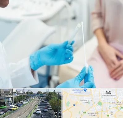 دکتر زگیل تناسلی HPV در جنوب تهران 