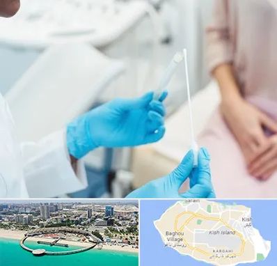 دکتر زگیل تناسلی HPV در کیش