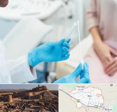 دکتر زگیل تناسلی HPV در بم