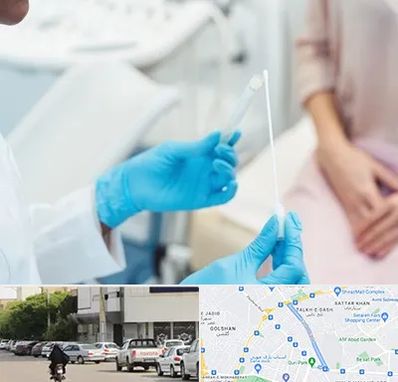 دکتر زگیل تناسلی HPV در قدوسی شرقی شیراز 