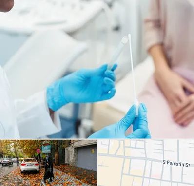 دکتر زگیل تناسلی HPV در خیابان فلسطین