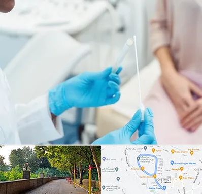 دکتر زگیل تناسلی HPV در فلکه گاز رشت 