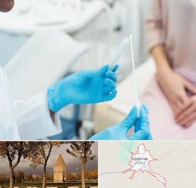 دکتر زگیل تناسلی HPV در تویسرکان
