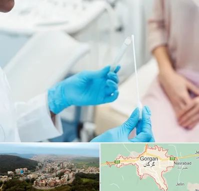 دکتر زگیل تناسلی HPV در گرگان