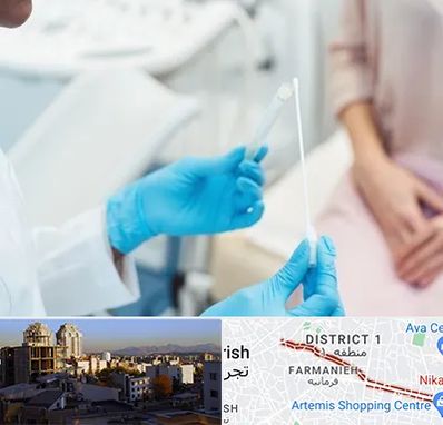 دکتر زگیل تناسلی HPV در فرمانیه 