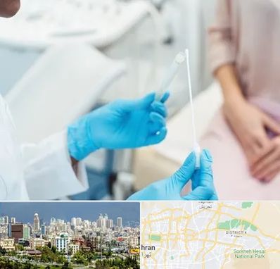 دکتر زگیل تناسلی HPV در شرق تهران 