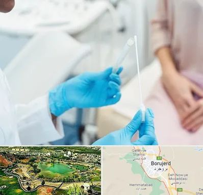 دکتر زگیل تناسلی HPV در بروجرد