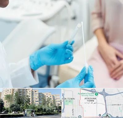 دکتر زگیل تناسلی HPV در آپادانا