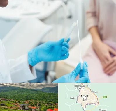 دکتر زگیل تناسلی HPV در آمل