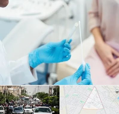 دکتر زگیل تناسلی HPV در سیدی مشهد