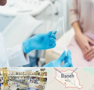 دکتر زگیل تناسلی HPV در بانه